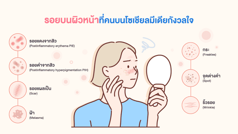 รอยบนผิวหน้าแต่ละประเภทที่คนบนโซเชียลมีเดียกังวลใจ